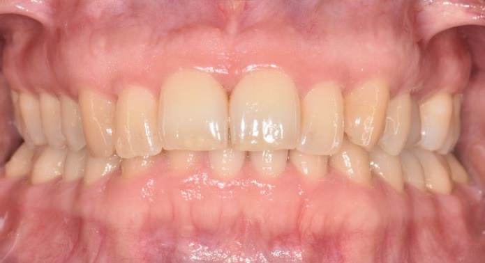 Healthy gums