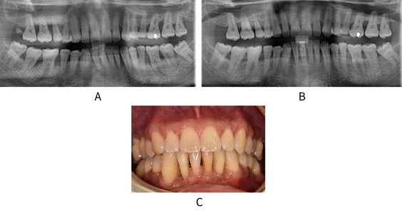 Before and after 5 years of supportive care